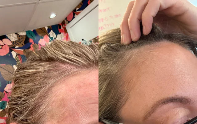 Baby Hairs Start Showing