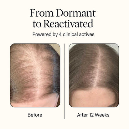 Dethera Root-Reactivator