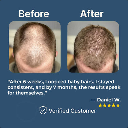 Dethera Root Reactivator