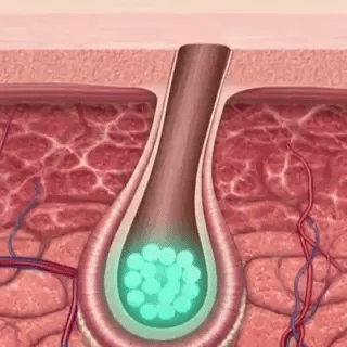 Follicle reactivates and grows