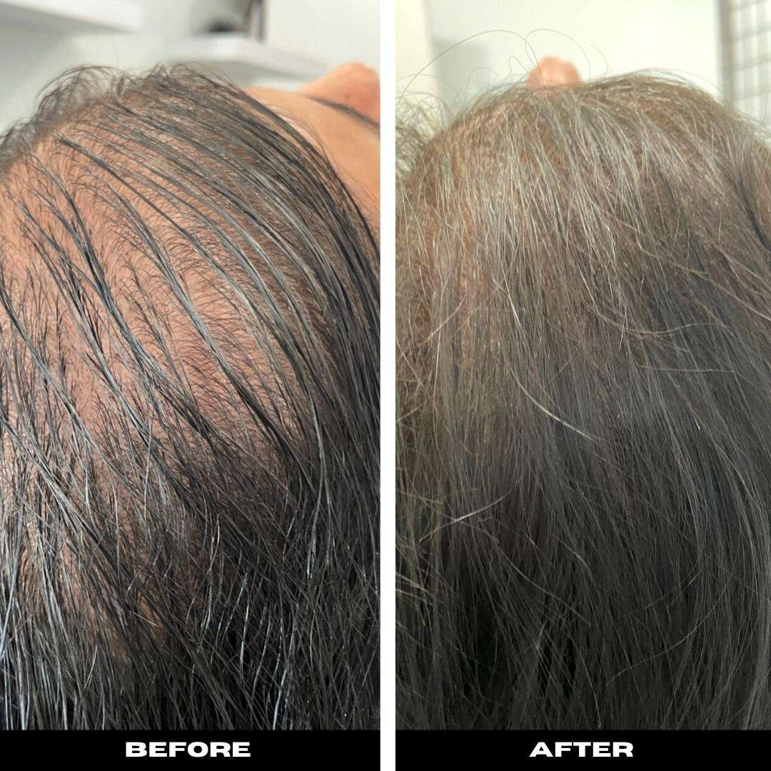 Visible Density Increase